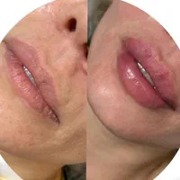 پاکسازی پوست ، ژل و بوتاکس در کلینیک زیبایی|خدمات آرایشگری و زیبایی|اهواز, پادادشهر|دیوار