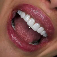 دندانپزشکی تخصصی ایمپلنت دیجیتالی و فوری|خدمات آرایشگری و زیبایی|تبریز, |دیوار