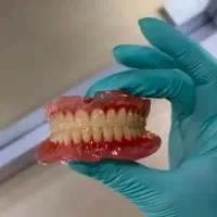 دندانسازی/دندان مصنوعی/ژله ای باشرایط استثنایی|خدمات زیبایی و سلامت|کرج, گوهردشت|دیوار