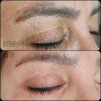 رفع اسکار بلفاروپلاستی بدون بازگشت|خدمات آرایشگری و زیبایی|اصفهان, چشمه باقرخان|دیوار