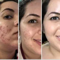 روغن های درمانی برند کاژان  صادرات به ۵۷ کشورجهان