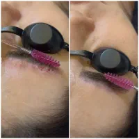 پاک کردن تتو (لیزر‌پیشرفته‌‌پیکو.شور)