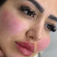 خدمات تخصصی تزریق ژل بوتاکس و زیبایی در منزل