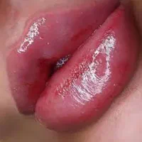 تزریق ژل و بوتاکس با بهترین متریال و جدیدترین متد|خدمات آرایشگری و زیبایی|هشتگرد, فاز ۳ مهستان|دیوار