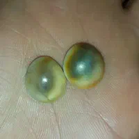 مهره