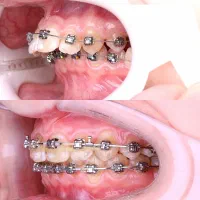جشنواره ویژه  دندانپزشکی وارتودنسی بدون چک و سفته|خدمات زیبایی و سلامت|تبریز, |دیوار