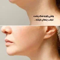 کلینیک زیبایی|خدمات آرایشگری و زیبایی|شیراز, فضل‌آباد|دیوار