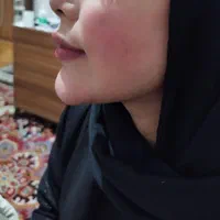 جشنواره تزریق ژل بدون درد و کبودی تضمینی|خدمات آرایشگری و زیبایی|جیرفت, |دیوار