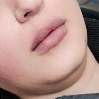 مرکز لیزر آیسل زرین شهر