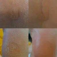 پدیکور تخصصی۳۰درصد تخفیف با معرفی نفر دوم|خدمات آرایشگری و زیبایی|شیراز, مسلم|دیوار