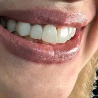 دندان سالم،لبخند درخشان،تعرفه ها همچنان مناسب