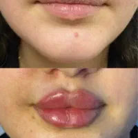 تخفیف ویژه