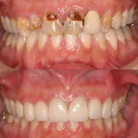 تکمیل البوم زیبایی کلیک‌کن|خدمات آرایشگری و زیبایی|قم, زنبیل آباد|دیوار