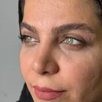 بلفارو لیزری با کمترین هزینه