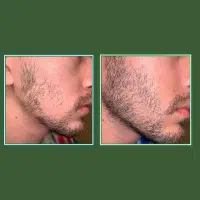 همه عاشقت میشن