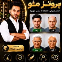 پروتز مو (ترمیم مو کاشان)