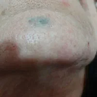 الکترولیز موی سفید وسیاه صورت بانوان فقط|خدمات آرایشگری و زیبایی|بروجرد, |دیوار