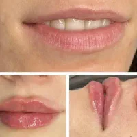 جشنواره تزریق ژل و بوتاکس در مطب با۴۰درصد تخفیف|خدمات آرایشگری و زیبایی|کرمانشاه, |دیوار