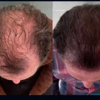 دیگه حتی فرق سرت هم مشخص نیست