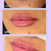 جشنواره پاییزی زیبایی در کلینیک ما آغاز شد...