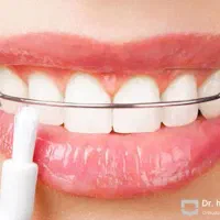 ارتودنسی رایگان کودکان ۶تا ۱۰ سال|خدمات آرایشگری و زیبایی|تهران, خاک سفید|دیوار