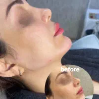 نیازمند مدل ژل لب و کانتورینگ(۱نفر)