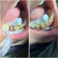 خدمات دندانپزشکی|خدمات آرایشگری و زیبایی|رشت, گلسار|دیوار