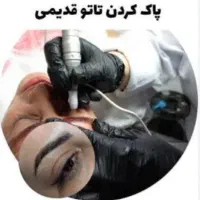 متخصص ریموو   تتوهای قدیمی ابرو وخط چشم وخط لب
