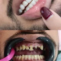 آموزش لبه شیشه و کامپوزیت