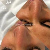 مدل فیشیال با تخفیف بابرند اکلادو|خدمات آرایشگری و زیبایی|شیراز, قالیشویی|دیوار