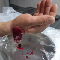 حجامت|خدمات آرایشگری و زیبایی|شاهرود, |دیوار