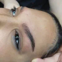 مدل میکروبلیدینگ