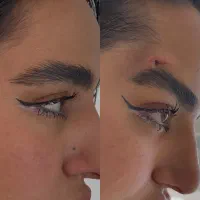 مرکز تخصصی لیفت با نخ و فیلر بادی