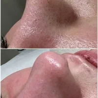 خدمات تخصصی فیشیال، رنگ ، مژه ، آرایش دائم|خدمات آرایشگری و زیبایی|شیراز, شریف‌آباد|دیوار
