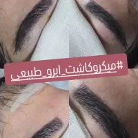 کاشت مو ،ریش،ابرو شیراز
