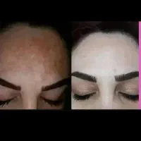 شوینده قوی صد در صد فرمول سفید کننده قوی