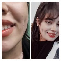 اموزش وخدمات چال گونه وپرسینگ در کلینیک|خدمات آرایشگری و زیبایی|کرمانشاه, |دیوار