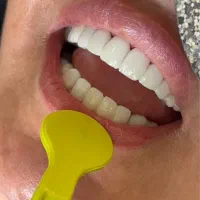 جشنواره تخفیف دندان خرماباد