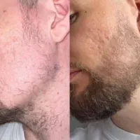 مثل لوبیای سحرامیز رشد بکن