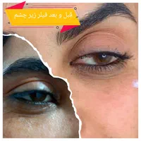 خدمات زیبایی|خدمات آرایشگری و زیبایی|کوهدشت, |دیوار