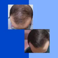 مشکلتو تضمینی حل میکنه