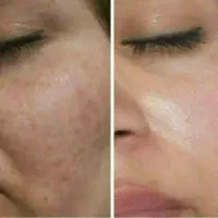 کرم معجزه اصلی با ضمانت|آرایشی، بهداشتی، درمانی|مشهد, طبرسی شمالی|دیوار