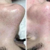 فیشیال و پاکسازی تخصصی مخصوص بانوان وآقایون