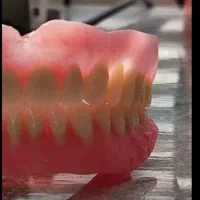 دندانسازی (دندان مصنوعی)|آرایشی، بهداشتی، درمانی|تبریز, |دیوار