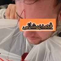حجامت. فصد زالوسم‌زدایی ماساژ طب سوزنی