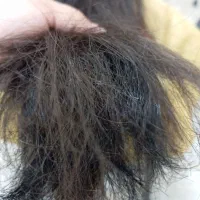 موخوره تراپی تخصصی به روش روسی