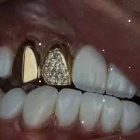 دندانپزشکی/ کامپوزیت دندان
