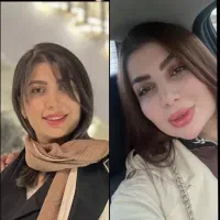 ژل و فیلرلب گونه زاویه فک کانتور نخ لیفت بوتاکس
