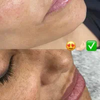 درمان مشکلات پوستی|خدمات آرایشگری و زیبایی|شاهین دژ, |دیوار