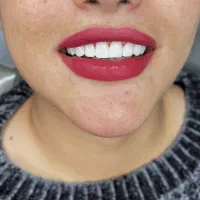 کامپوزیت 20تومن|خدمات آرایشگری و زیبایی|دورود, |دیوار